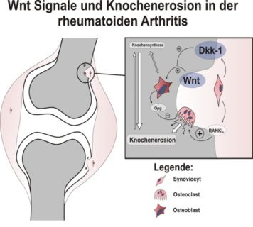 Zum Artikel "Knochen und Skelettsystem – Dickkopf-1 ist ein Hauptregulator des Gelenkumbaus"