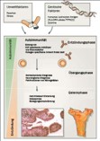 Zum Artikel "Zytokine in der Entstehungsphase der rheumatoiden Arthritis"