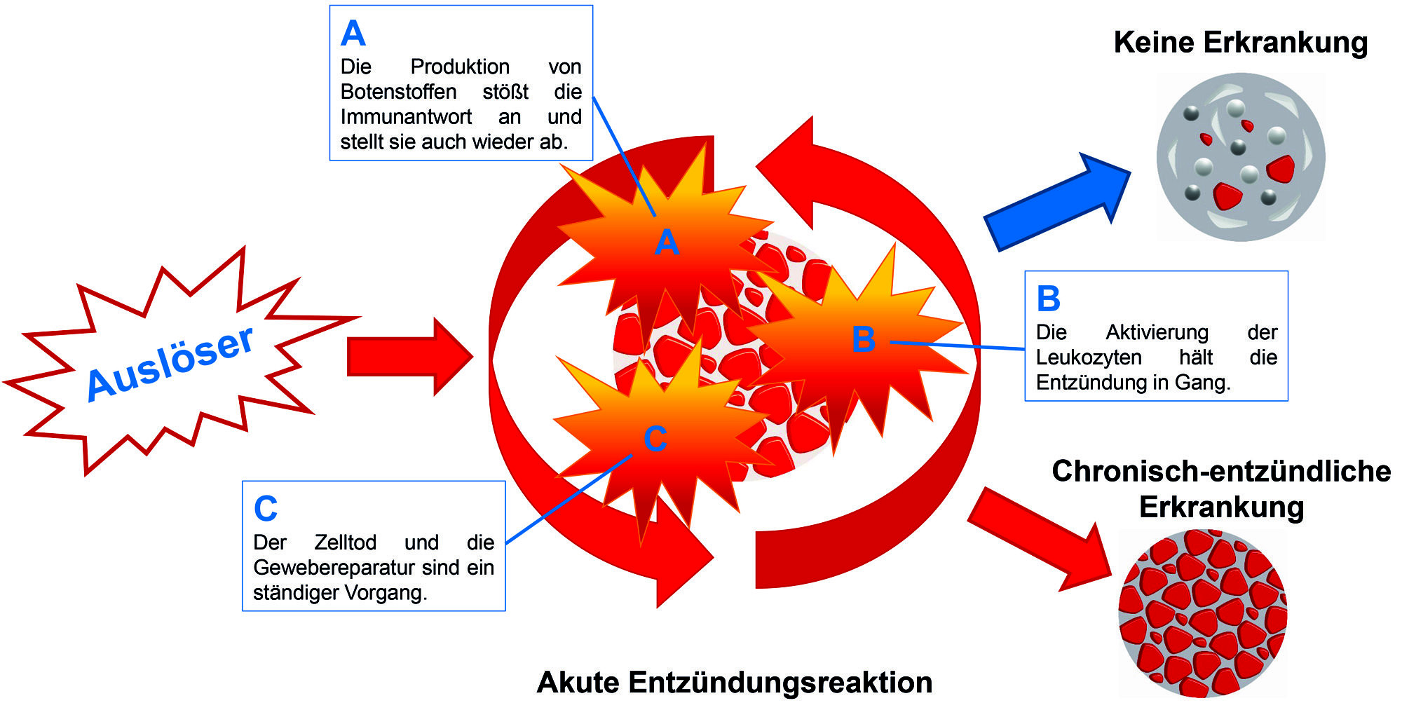 Zum Artikel "Dem Entzündungsstopp auf der Spur"