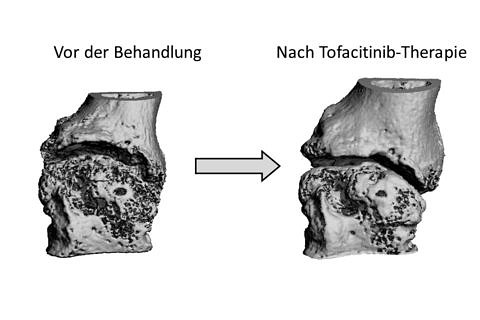 Zum Artikel "Zwei Fliegen mit einer Klappe: Entzündung gehemmt, Knochenheilung gefördert"