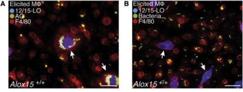 Zum Artikel "Autoimmunität – Koordinierte Mülltrennung durch Fresszellen im Immunsystem"