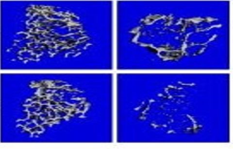 Zum Artikel "Auflösung von Entzündung – Der Botenstoff Interleukin-9 hilft bei Arthritis"