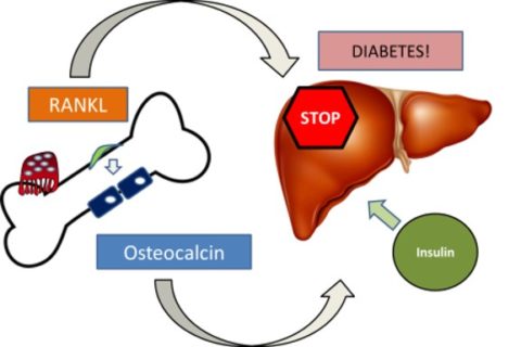 Zum Artikel "Diabetes – Protein des Knochenumbaus zeigt Diabetes-Risiko an"