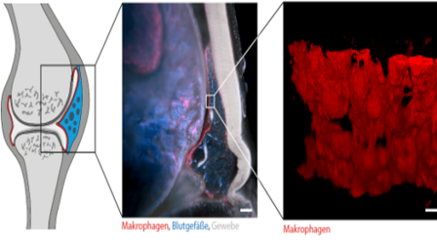 Zum Artikel "Einblicke in das Gelenk – Eine Membran aus Fresszellen"
