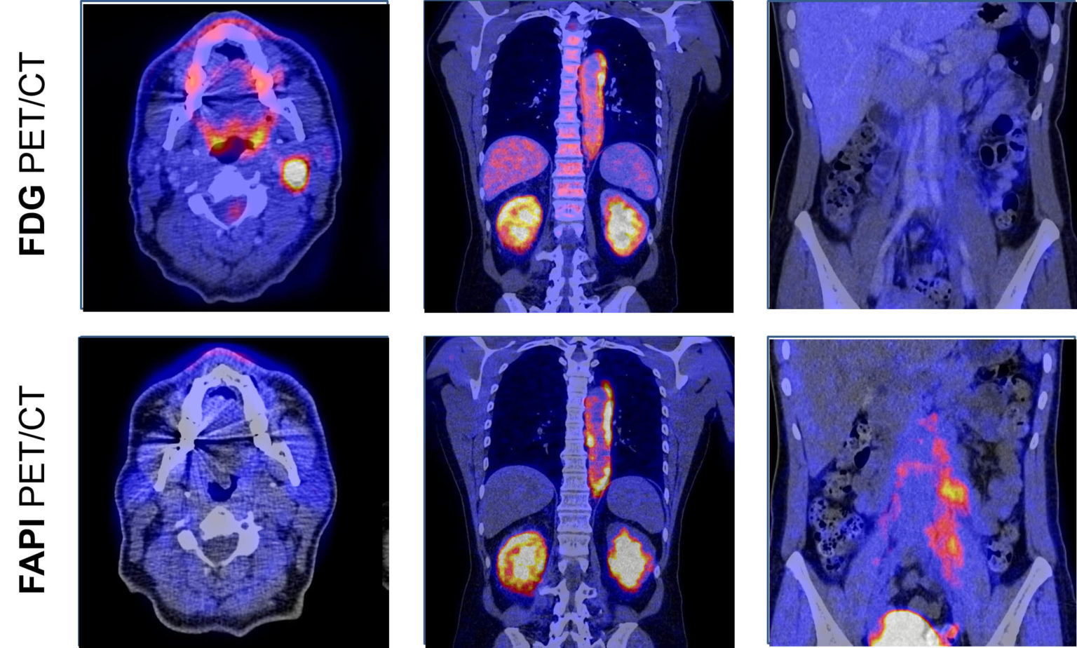 Fibrose sichtbar machen und verstehen Sonderforschungsbereich 1181